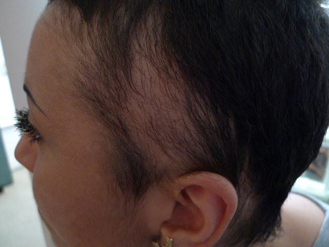 After image