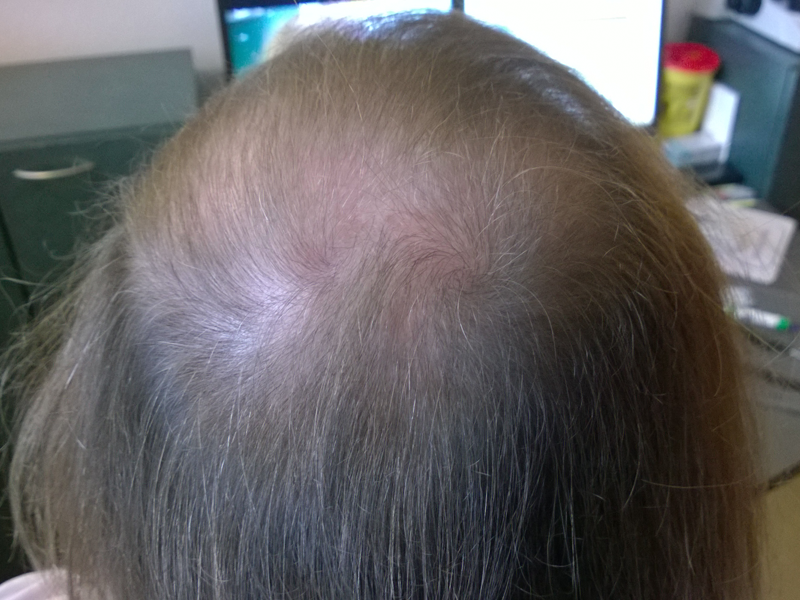 Before image