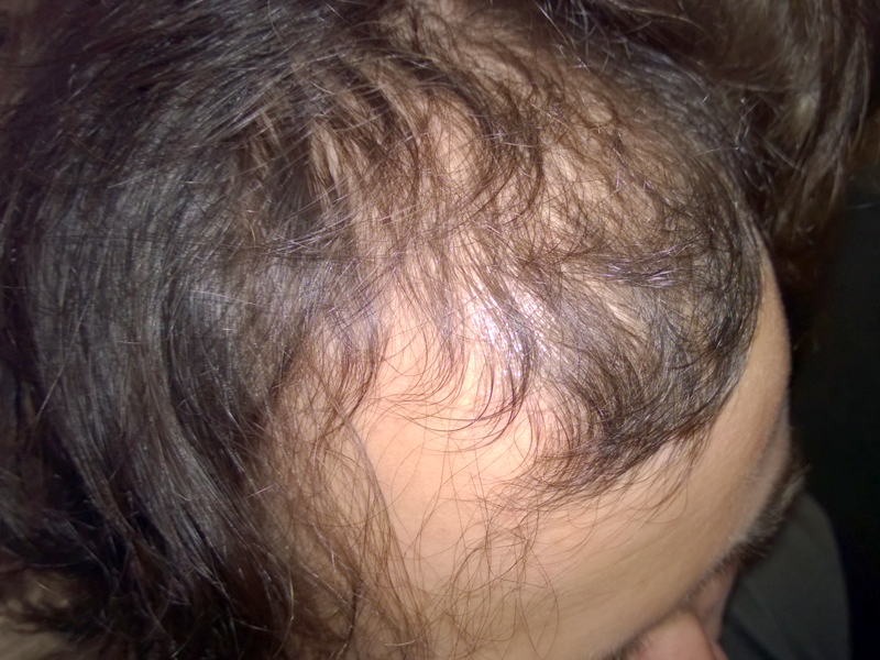 Before image
