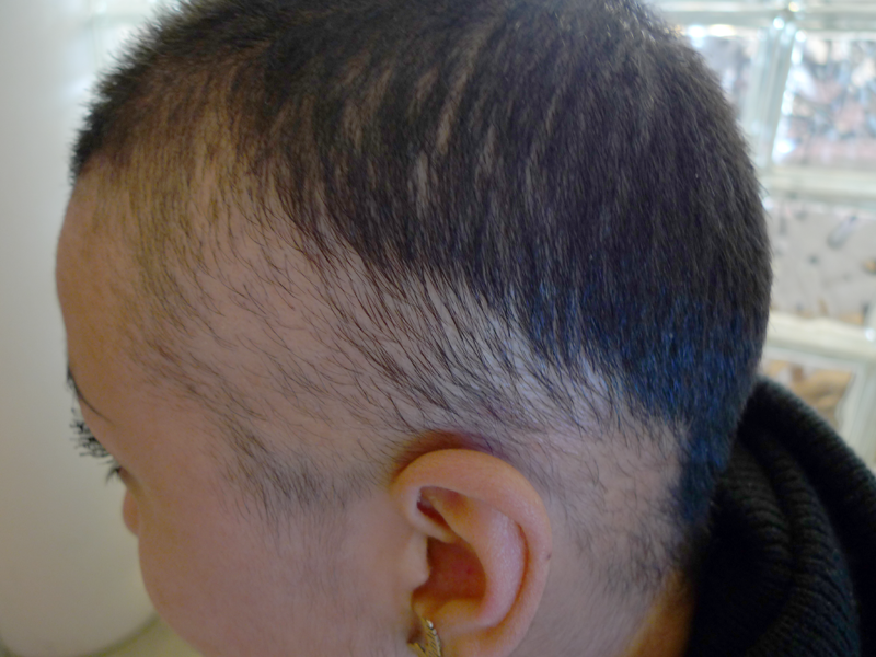 Before image