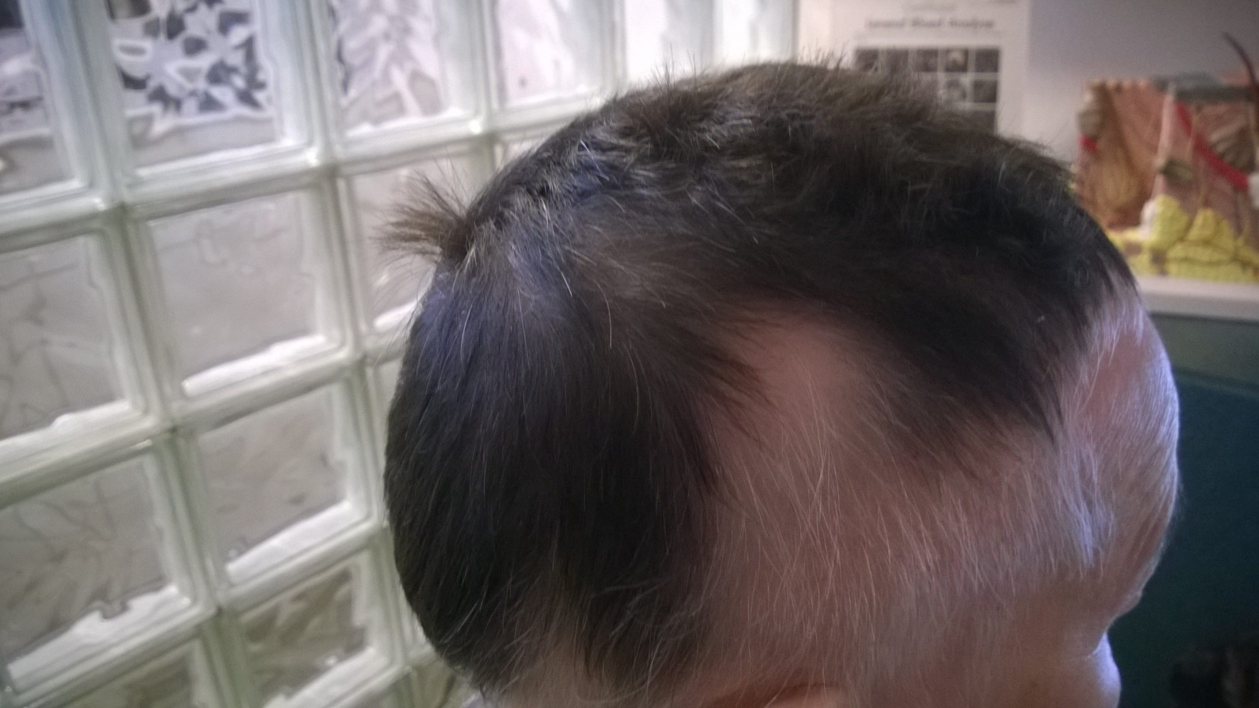 Before image