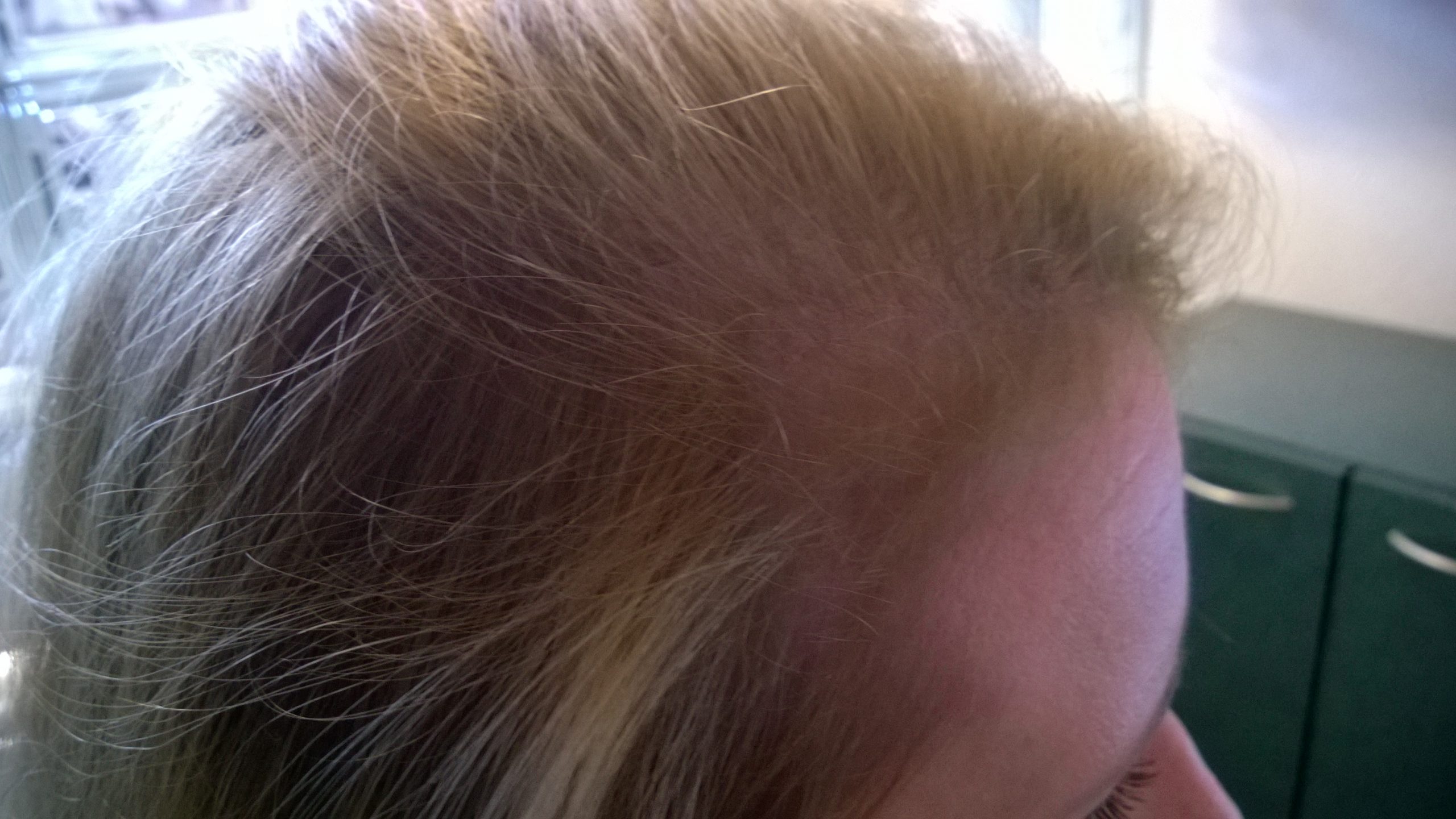 Before image