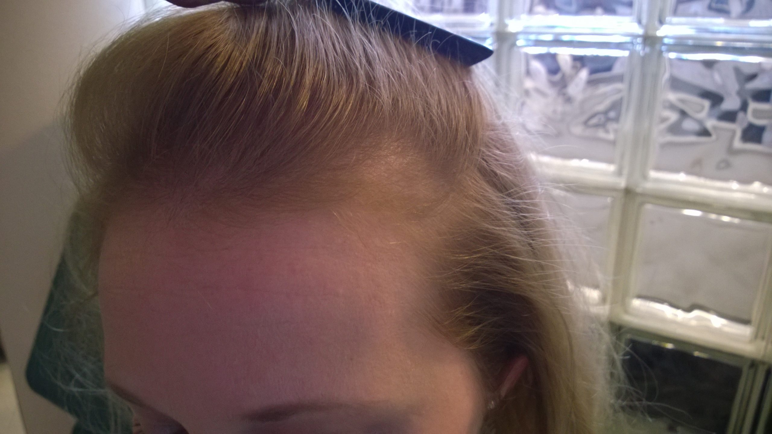 Before image